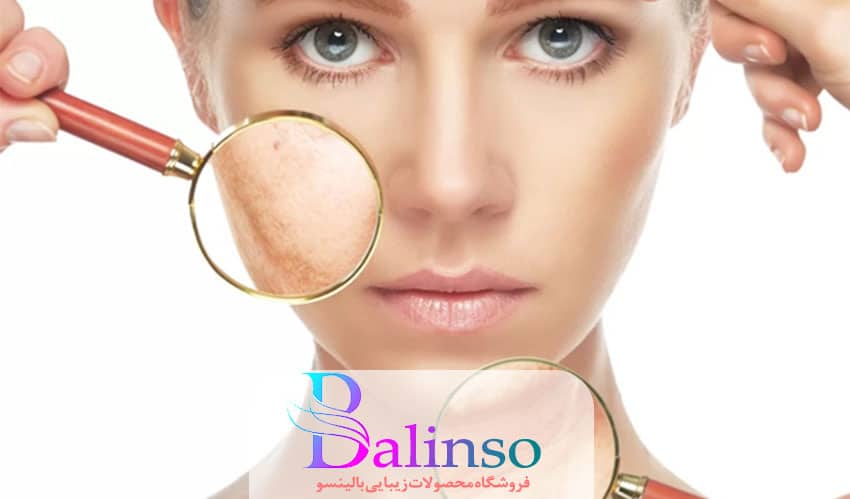 درمان مشکلات زیبایی پوست با روغن آرگان ملک بیو (Malak bio) بالینسو